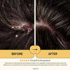 ScalpCalm Shampoo • Scalp Barrier Repair