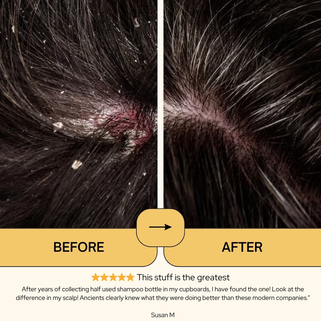 ScalpCalm Shampoo • Scalp Barrier Repair
