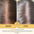 ScalpCalm Shampoo • Scalp Barrier Repair