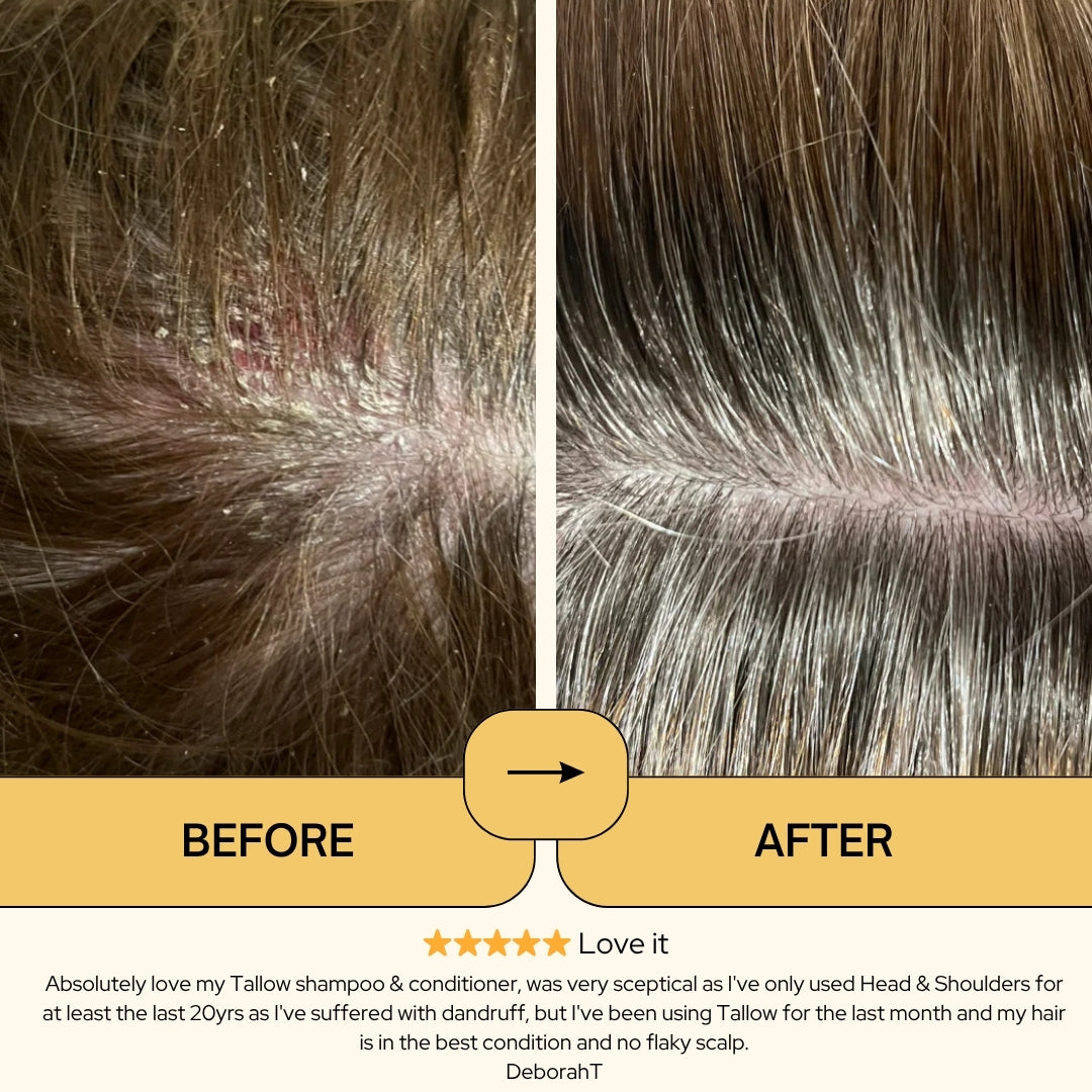 ScalpCalm Shampoo • Scalp Barrier Repair
