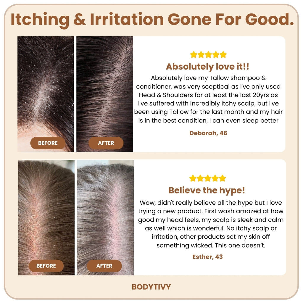 Natural Beef Tallow Plus Shampoo • Scalp Barrier Repair • Free Gifts