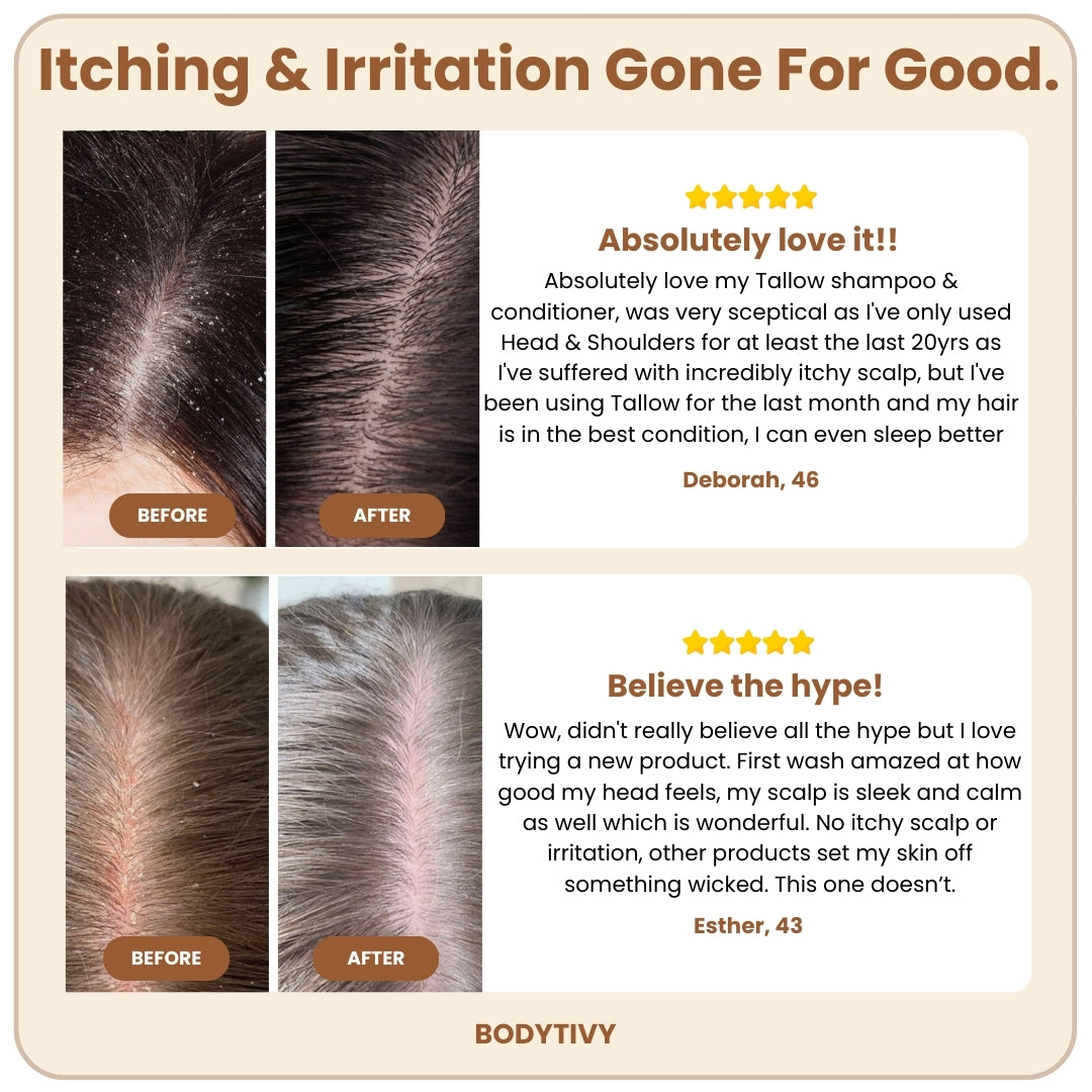 Natural Beef Tallow Plus Shampoo • Scalp Barrier Repair • Free Gifts