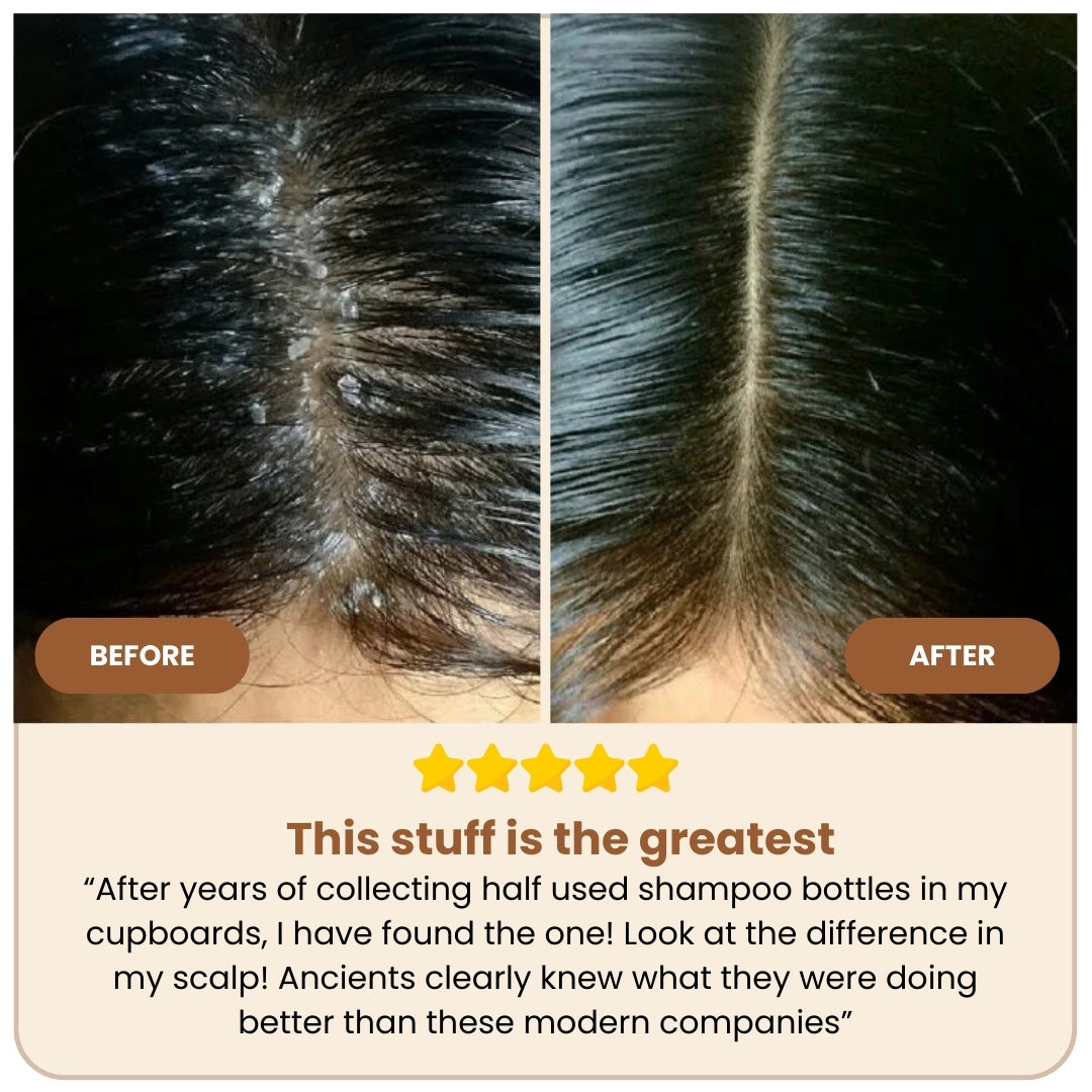 Natural Beef Tallow Plus Shampoo • Scalp Barrier Repair • Free Gifts